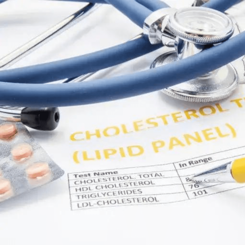Stay updated with the latest cholesterol guidelines and how they can impact your health. Learn more in this informative blog post.