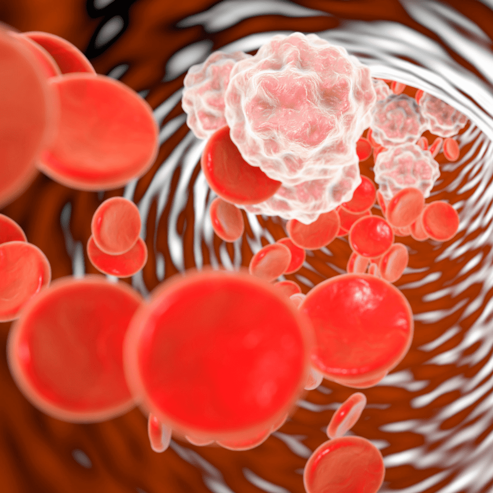 Learn about chronic inflammation and its impact on your health. Discover ways to reduce inflammation naturally and improve overall wellness.
