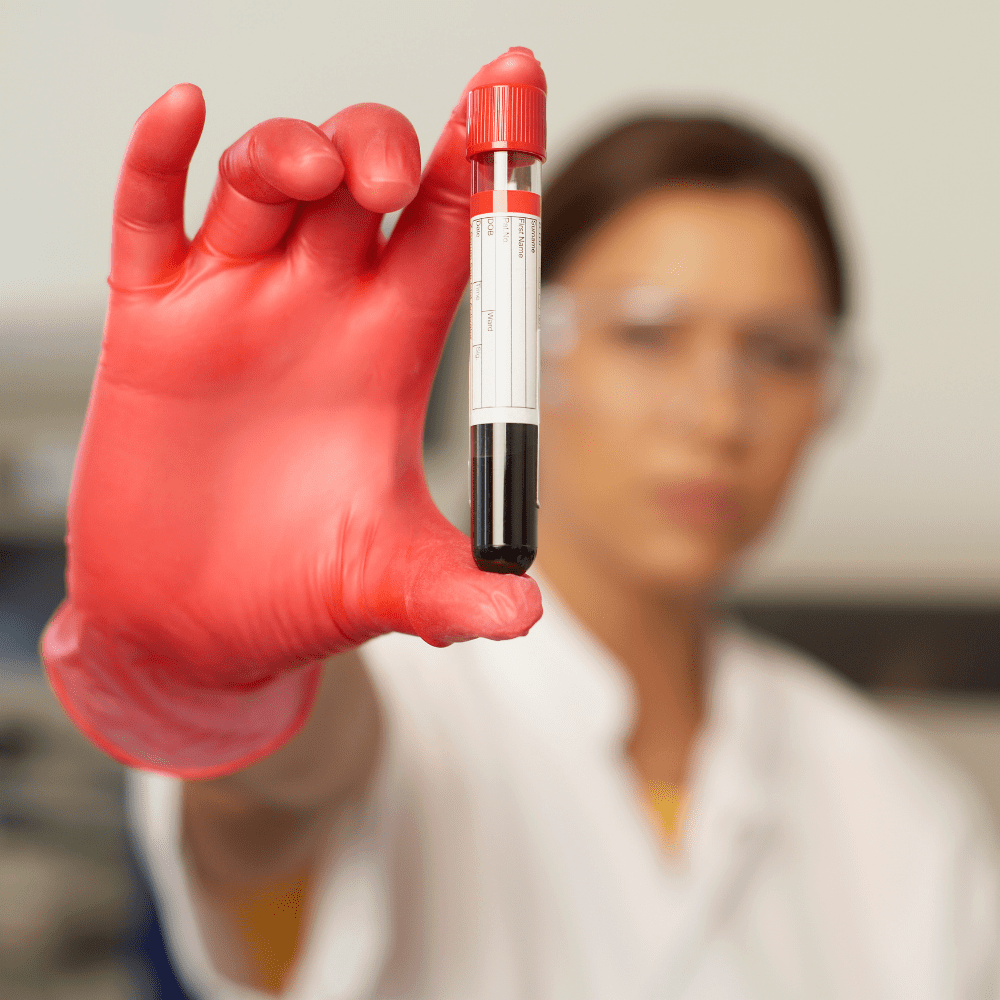 Uncover the hidden dangerous cholesterol that is largely ignored in modern medicine and what to do about it for your health