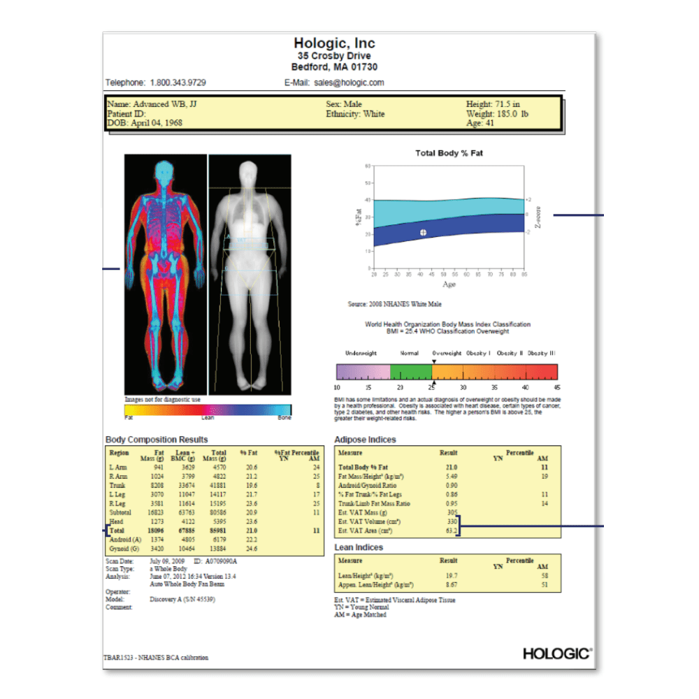A Hologic DEXA body comp report gives you detailed and science-backed information about your body composition