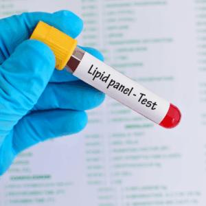 The American College of Cardiology (ACC) lipid issued 2026 guidelines.